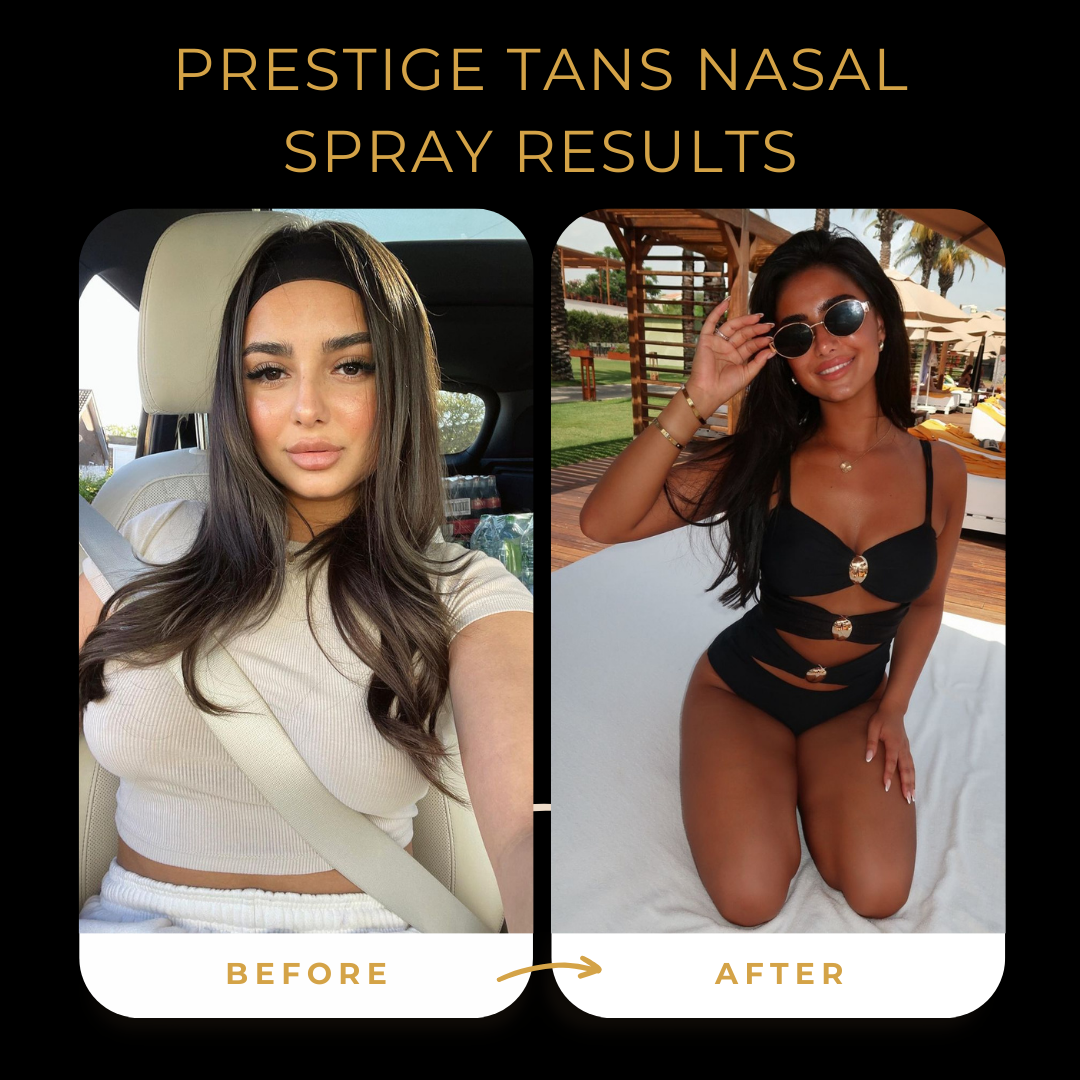 Before and After Prestige Tans